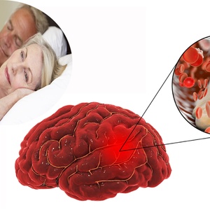 Bệnh mất ngủ - có thể do thiếu máu não