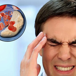 Suy giảm tuần hoàn não gia tăng trong thời buổi hiện nay