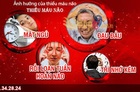Triệu chứng điển hình của thiếu máu não