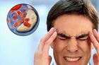 Suy giảm tuần hoàn não gia tăng trong thời buổi hiện nay